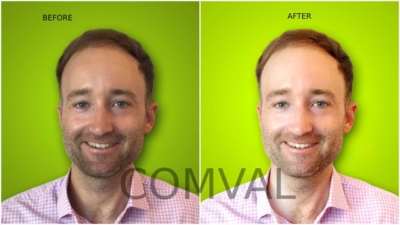 1. Before After 1